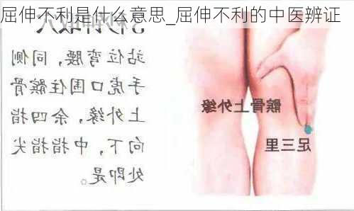 屈伸不利是什么意思_屈伸不利的中医辨证