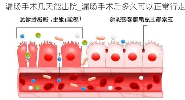 漏肠手术几天能出院_漏肠手术后多久可以正常行走