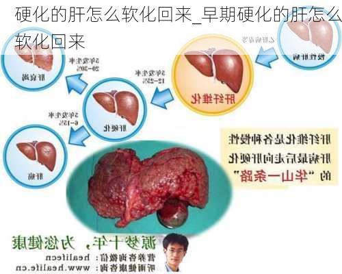 硬化的肝怎么软化回来_早期硬化的肝怎么软化回来