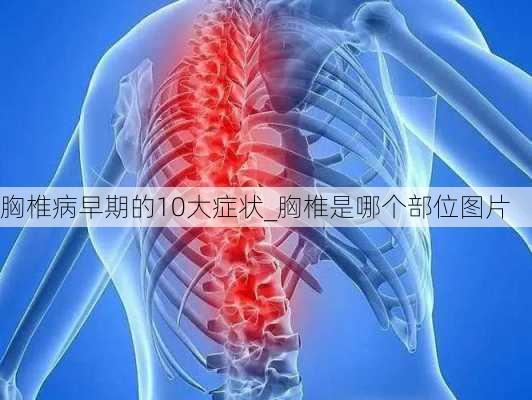 胸椎病早期的10大症状_胸椎是哪个部位图片